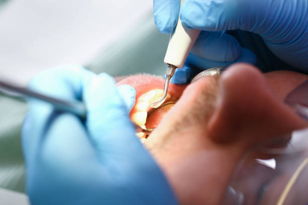 Best Pediatric Emergency Dentist in Washington, GA