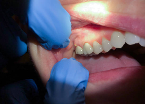 Best Emergency Dental Services for Seniors in Washington, GA